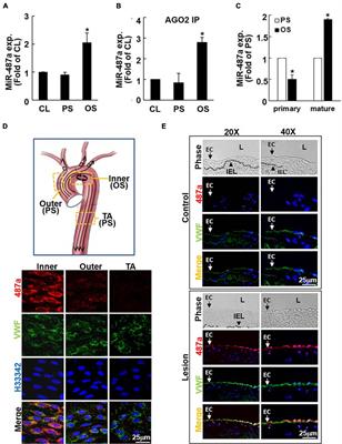 Mechanoresponsive Smad5 Enhances MiR-487a Processing to Promote Vascular Endothelial Proliferation in Response to Disturbed Flow